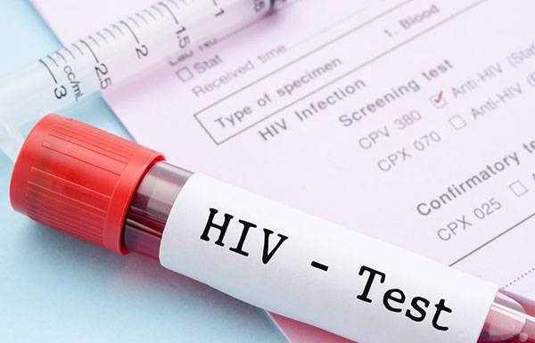 Dinkes Lebak Temukan 25 Kasus HIV/ AIDS Selama 2020