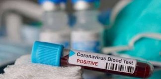 Kasus Positif COVID-19 Di Lebak Bertambah 7 Orang