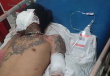 Juru Parkir Di Pasar Rau Dibacok, Polisi Kantongi Identitas Pelakunya